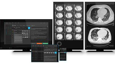 Launch of a Web-based system for the observation and transmission of focused medical images (PACS) in five hospitals of Markazi province